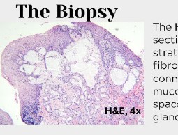 Detail of an oral pathology biopsy report