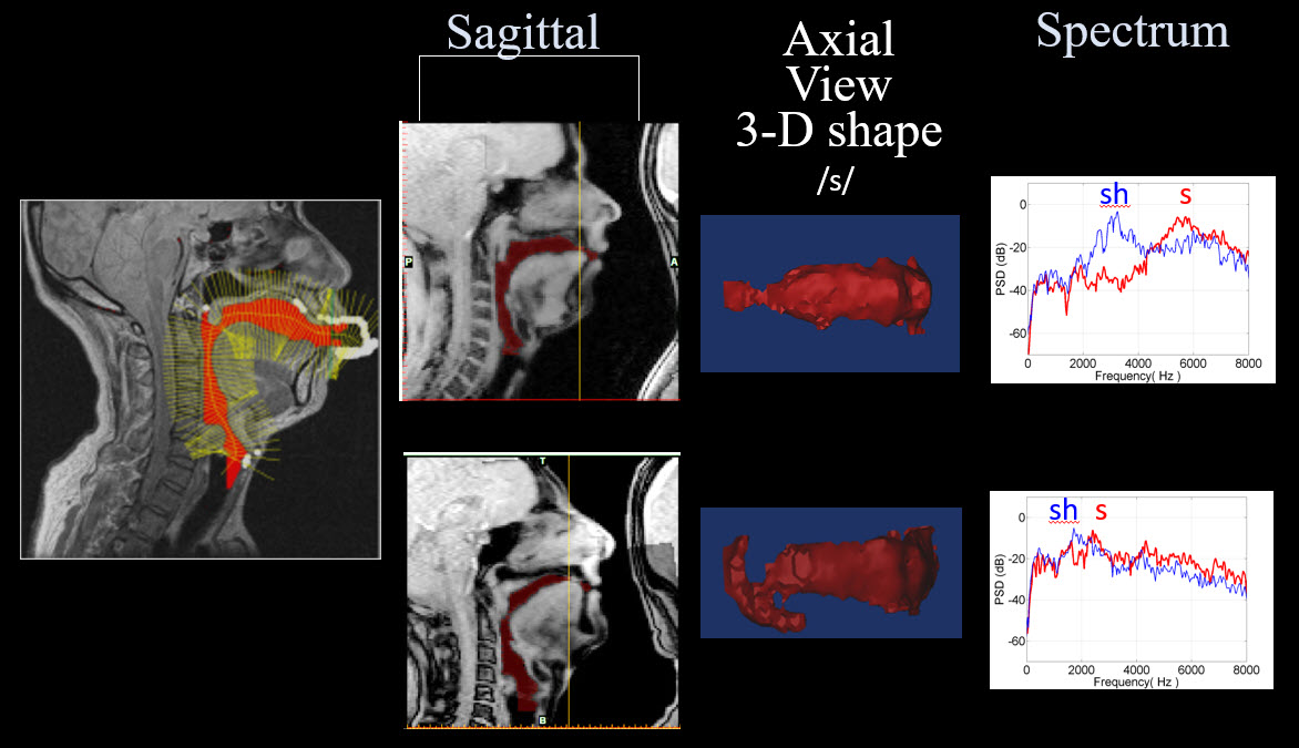 A collection of images illustrating sagittal, axial, and spectrum views of someone vocalizing the letter S