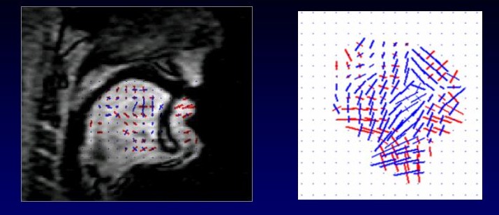 Schematic of tongue in motion, demonstrating two orthogonal directions of primary stretch.