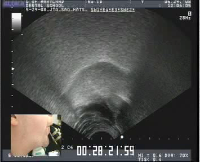 JTG_clarinet_F2