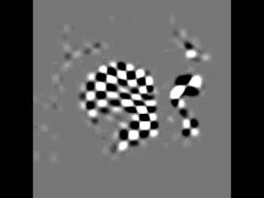 MRI of tongue in motion