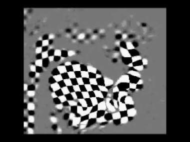 MRI of tongue in motion