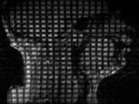 mri_ku_mid1_image