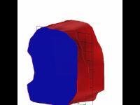 mri_reconstruction_1