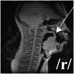 tsegmri2