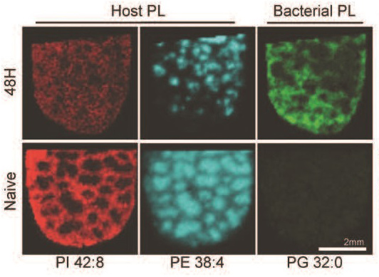 Host-pathogen lipid images from Francisella Novicida infected mouse spleens using mass spectrometry imaging. 