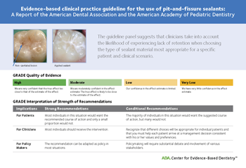 ADA Chair-side guide for use of pit-and-fissure sealants