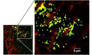 Host-Pathogen Interactions in Chronic Infections