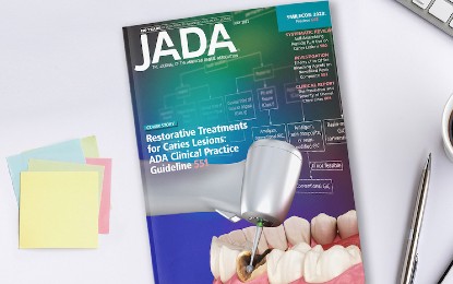 American Dental Association Releases New Clinical Practice Guidelines on Caries