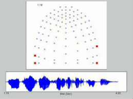 Screenshot of computer animation of electropalatography scan