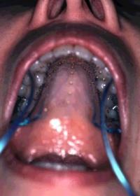 epg_palate_in_mouth