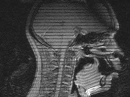 MRI image