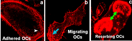 Figure 1: Confocal images of osteoclasts demonstrating podosomes at the cell periphery and leading edge  (a &b); resorbing OC demonstrates sealing rings.